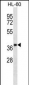 OR5F1 Antibody (C-term)